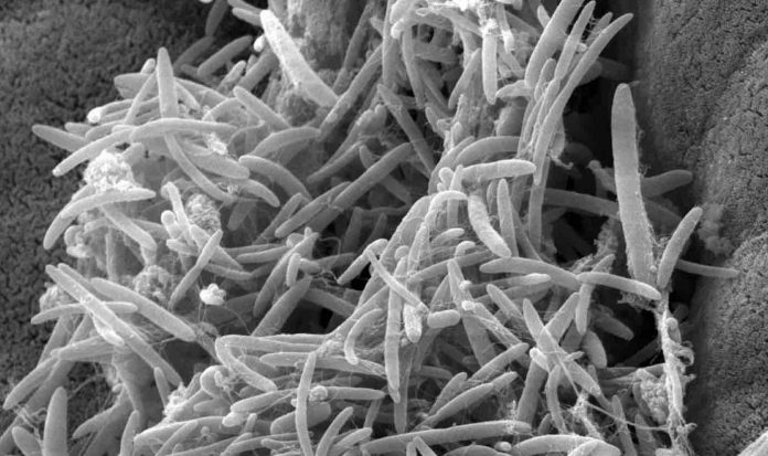 New Research Shows That Gut Microbes May ‘Significantly’ Slow the ...