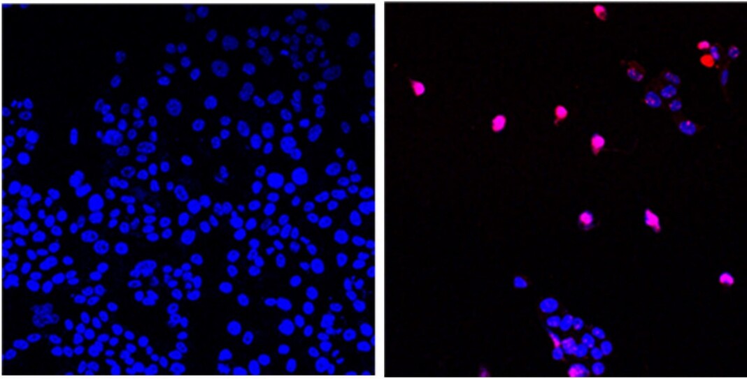 Molecule That Kills Most Solid Cancer Tumor Cells Leaving Others ...