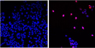 Molecule That Kills Most Solid Cancer Tumor Cells Leaving Others ...